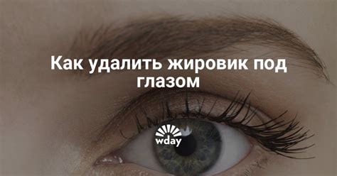 Удаление жировиков в Киеве: цены, лучшие врачи, результат и отзывы ...