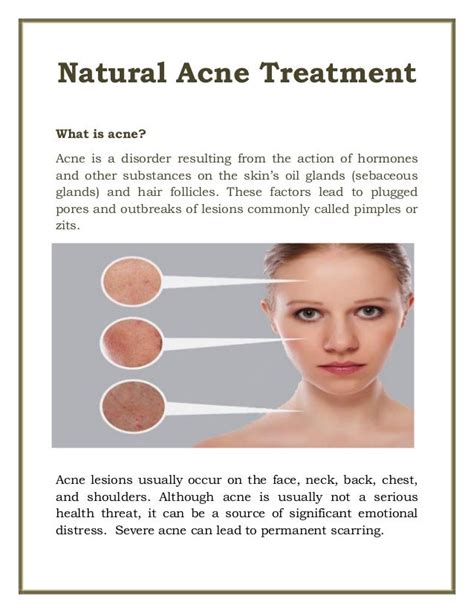 Natural Acne Treatment