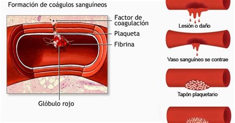 LA HEMOFILIA COAGULACIÓN DE LA SANGRE