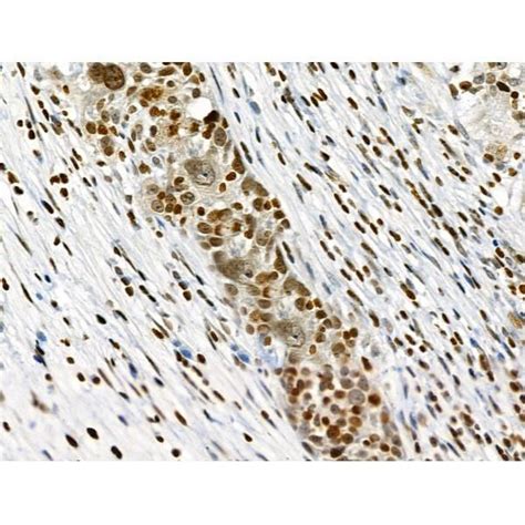 Polyclonal Cib1 Antibody MyBioSource