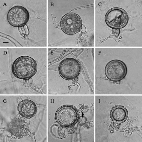 Colony Morphology Of Phytophthora Hydrogena Isolates On Various Media