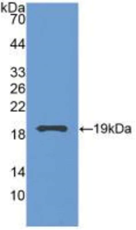 Grancalcin Polyclonal Antibody Invitrogen L Unconjugated