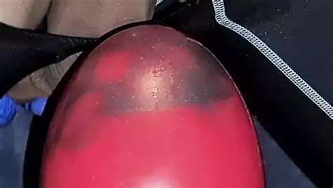 Extreme Analdehnung Mit Dem Lieblingsball Free Gay Porn Ba Xhamster