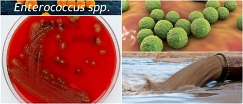 Enterococcus Spp ¿qué Es ¿dónde Se Encuentra Causas De Infección