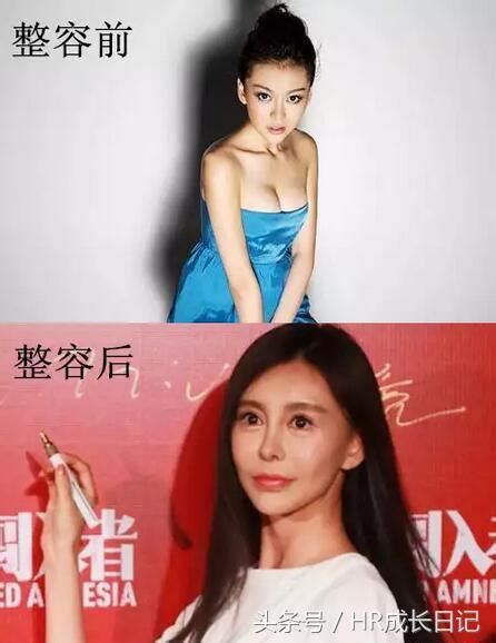 9位女星整容前後大對比，鄭爽整美了，徐海星鞏新亮整的嚇人！ 每日頭條