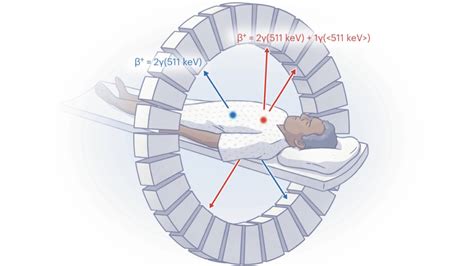 Nuclear medicine Archives – Physics World