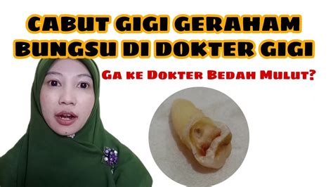 PENGALAMAN CABUT GIGI GERAHAM BUNGSU ATAS YouTube