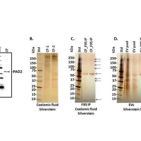 Mechanisms Of Peptidylarginine Deiminases Pads In Hi And Synergistic