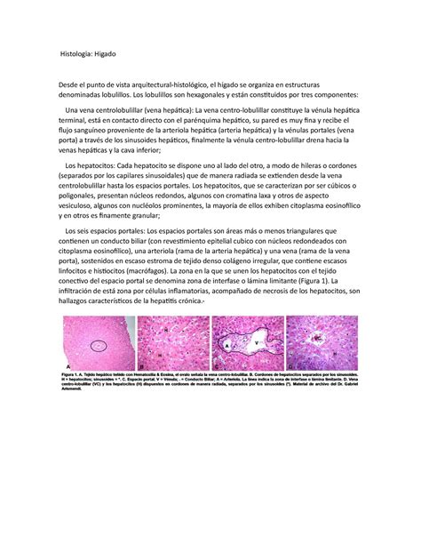 Histología Del Hígado Apuntes Histología General Uss Studocu