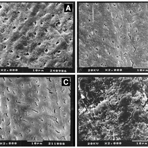 Scanning Electron Microscope Photomicrographs Magnification Of