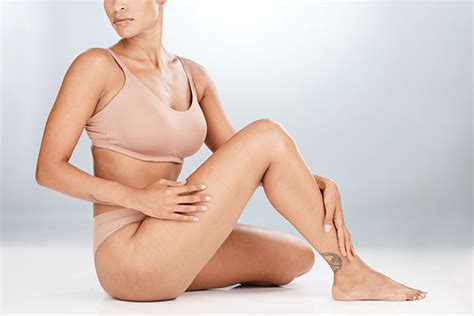 Stretch Mark Removal Laser Treatment Chelmsford Ma