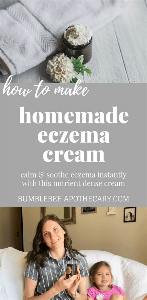 How To Make A Natural Homemade Eczema Cream Artofit