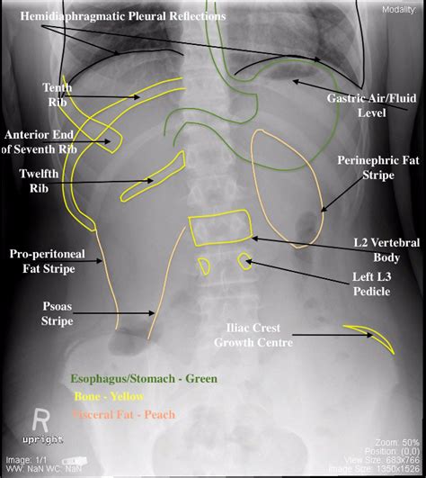 Pediatric Undergraduate Diagnostic Imaging Fundamentals