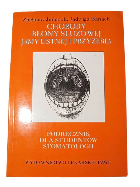 Choroby B Ony Luzowej Jamy Ustnej I Przyz Bia Banach Ja Czuk