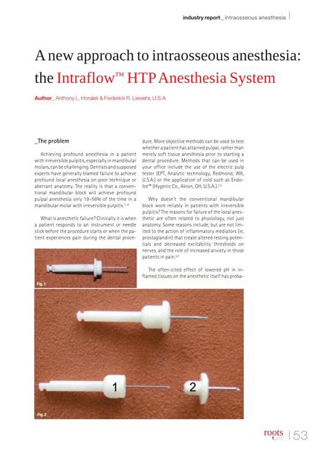 Pdf Anew Approach To Intraosseous Anesthesia The Intraflow