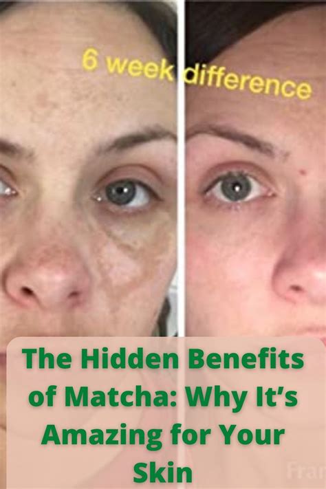 The Hidden Benefits Of Matcha Why Its Amazing For Your Skin