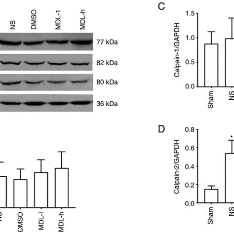 Western Blotting Analysis For Il 1β And Tnf α A Representative