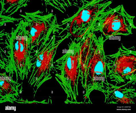 Fibroblast Cells Coloured Transmission Electron Micrograph Tem Of A