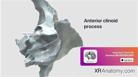 Anterior Clinoid Process Youtube