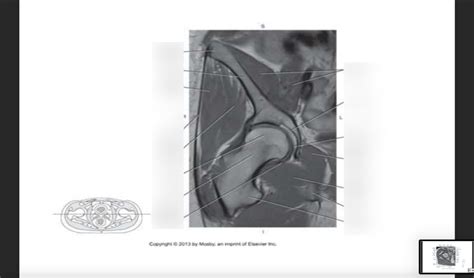 Sectional Anatomy 47 Diagram Quizlet