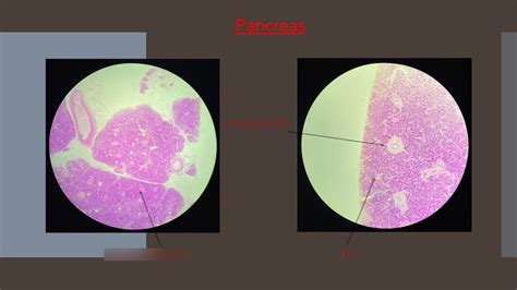 Pancreas Diagram Quizlet