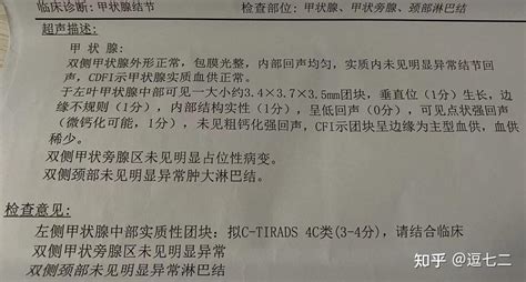 我的4c评级甲状腺结节治疗之路 记录1 知乎