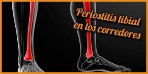 Periostitis Tibial Qu Es Causa S Ntomas Y Tratamiento Para Ello