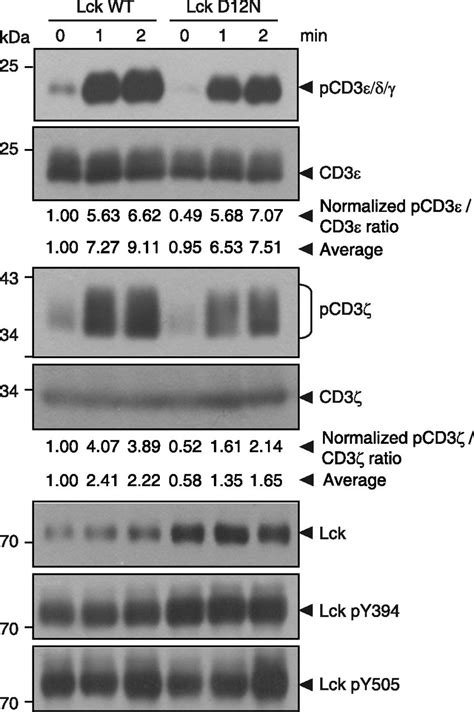 Ionic CD3Lck Interaction Regulates The Initiation Of T Cell Receptor