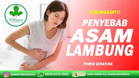 Terungkap Penyebab Asam Lambung Dan Maag Dan Cara Mengobati Asam