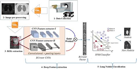 Workflow Of The Proposed Bilinear Cnn Model For Lung Nodule