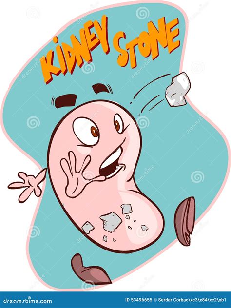 Kidney Stones Cartoon Vector | CartoonDealer.com #53496655