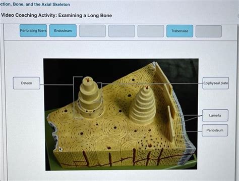 Solved Ction Bone And The Axial Skeleton Video Coaching Chegg