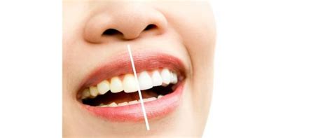 trik simpel bersihkan plak membandel pakai  jenis sayuran gigi auto