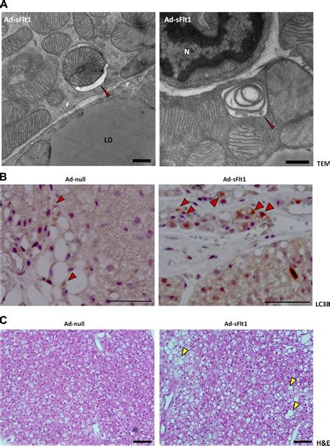 VEGF Neutralization Results In Brown Adipocyte Mitophagy A Electron