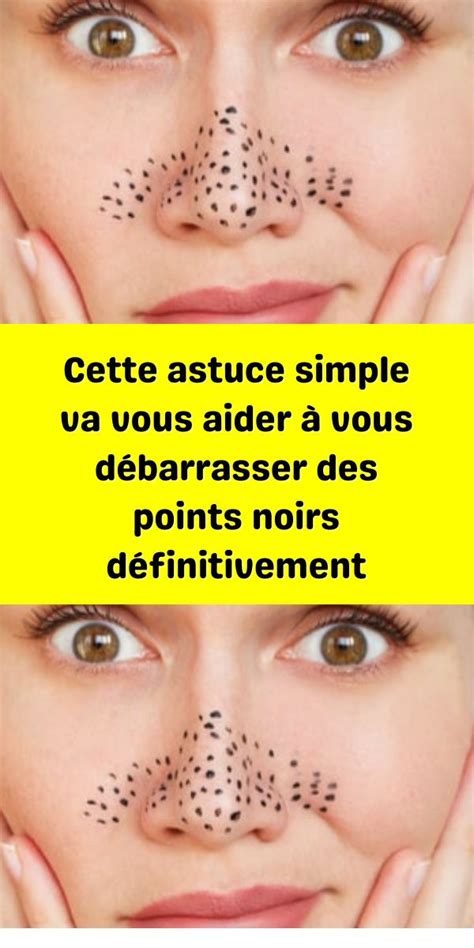 Cette Astuce Simple Va Vous Aider Vous D Barrasser Des Points Noirs