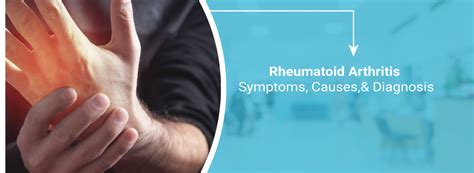 Rheumatoid Arthritis Ra Symptoms Causes And Diagnosis