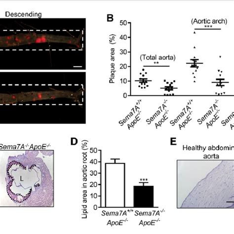 Sema7a Semaphorin 7a Deletion Reduces Lipid Deposition In The Aorta