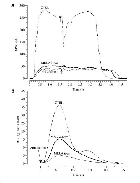 Maximal Voluntary Contraction MVC And Electrical Evoked Resting