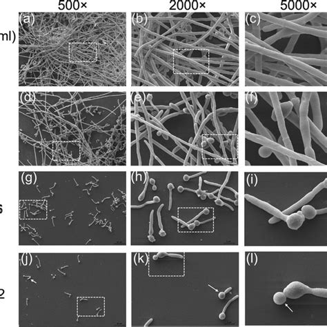 Effects Of EE On C Albicans Biofilm Formation Shown In CLSM Images