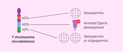 Types Of Y Chromosome Microdeletions