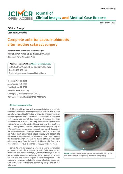 PDF Complete Anterior Capsule Phimosis After Routine Cataract Surgery