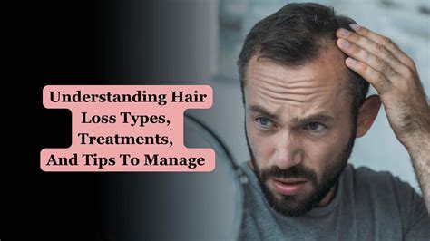 Understanding Hair Loss Types Treatments And Tips To Manage Diyun Times