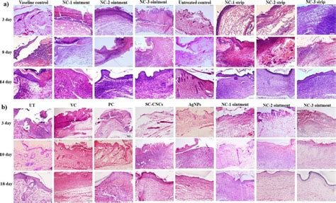 Bright Field Micrographs Of Hematoxylin And Eosin H E Stained Wounded