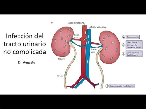 Infecci N De V As Urinarias Microbiolog A Cuadro Cl Nico