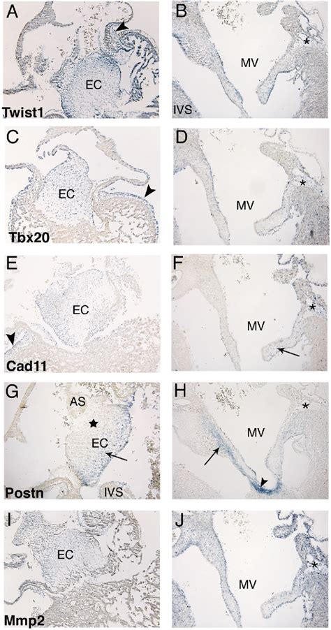 Figure From Twist Function In Endocardial Cushion Cell Proliferation