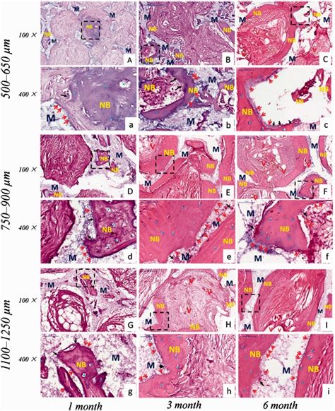 Ectopic Osteogenesis And Angiogenesis Regulated By Porous Architecture