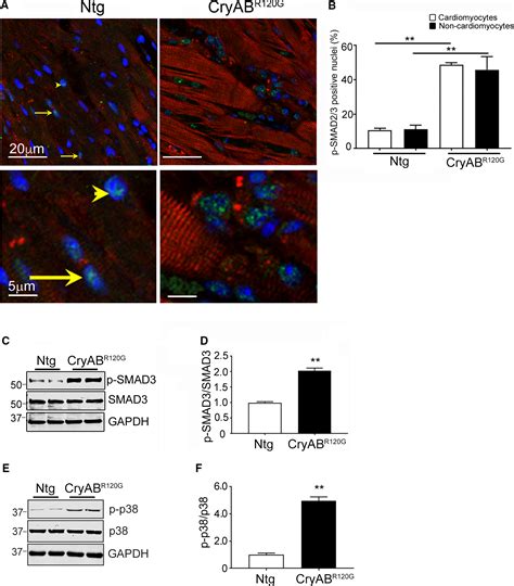 Cardiac Fibrosis In Proteotoxic Cardiac Disease Is Dependent Upon