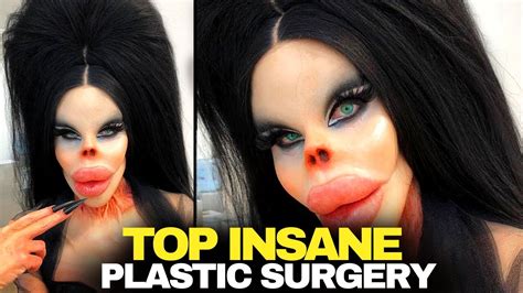 10 Unusual People Who Took Plastic Surgery Too Far Youtube