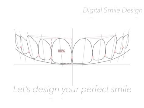 Digital Smile Design North East Dental Solutions