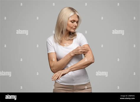 Dermatitis Eczema Allergy Psoriasis Concept Annoyed Mature Woman